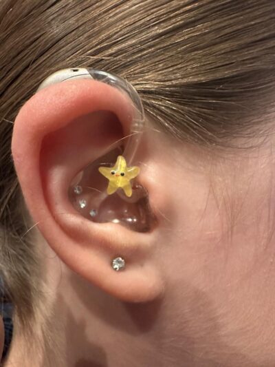 Sunny der gelbe Seestern – Hörgeräteschmuck für Kinder