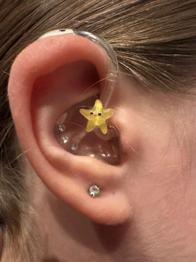 Sunny der gelbe Seestern – Hörgeräteschmuck für Kinder – Bild 2